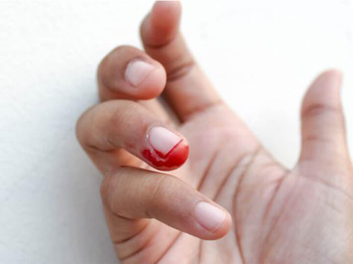Điềm báo cắt trúng tay may mắn