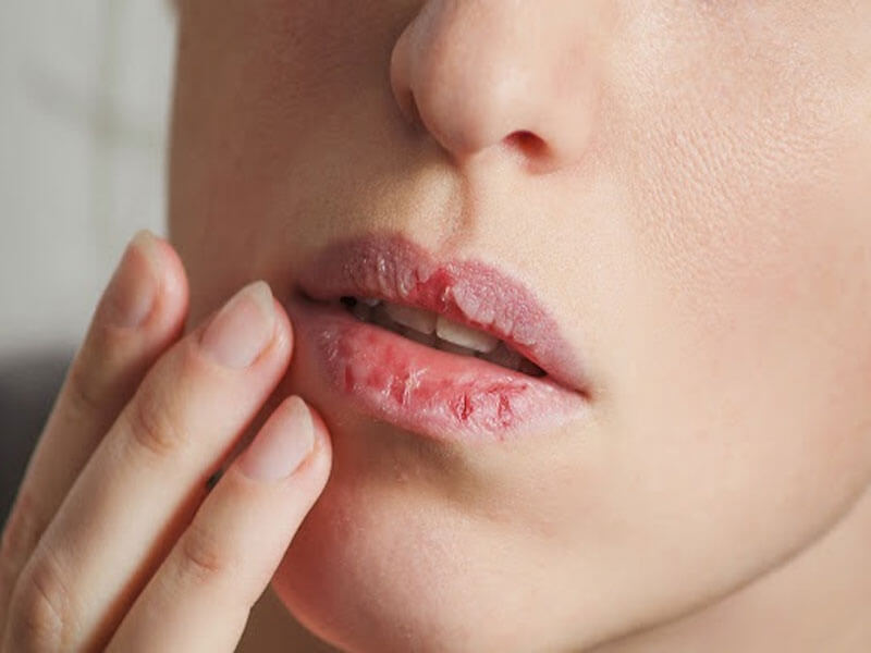 Điềm báo cắn vào môi